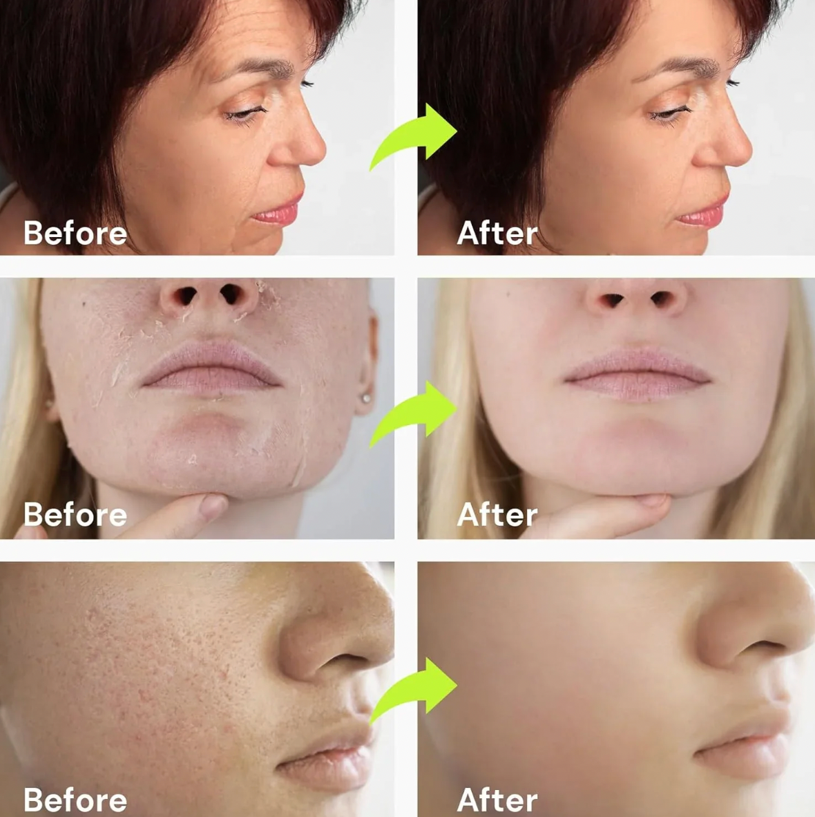 Revitalize Your Skin with Siegen Botox Retinal Firming Cream for a Youthful Glow